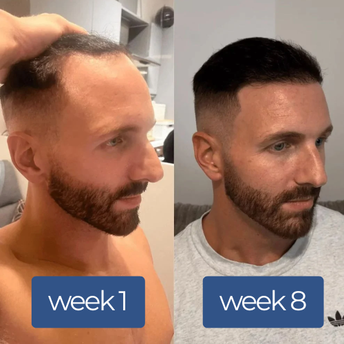 Reboot Labs™ Deoxyribose Hair Growth Serum