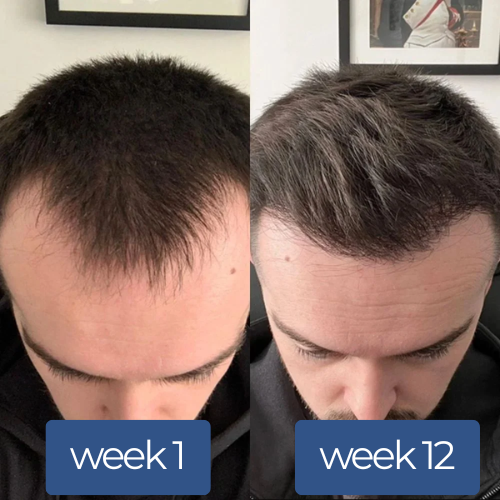 Reboot Labs™ Deoxyribose Hair Growth Serum