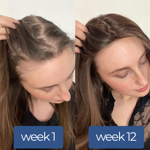 Reboot Labs™ Deoxyribose Hair Growth Serum