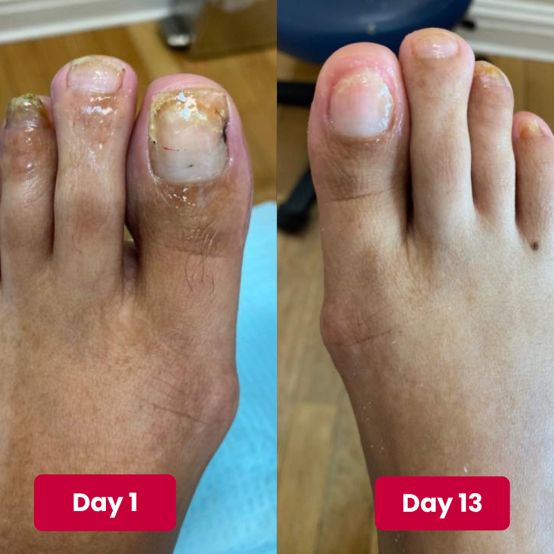 Reboot Labs™ Anti-Fungal Ointment