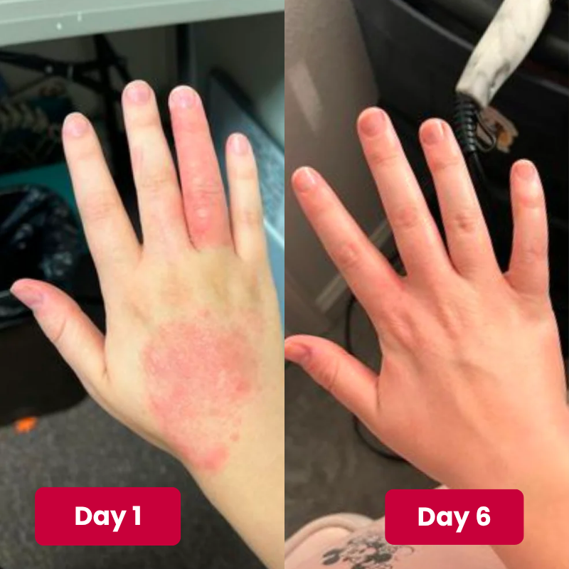 Reboot Labs™ Anti-Fungal Ointment