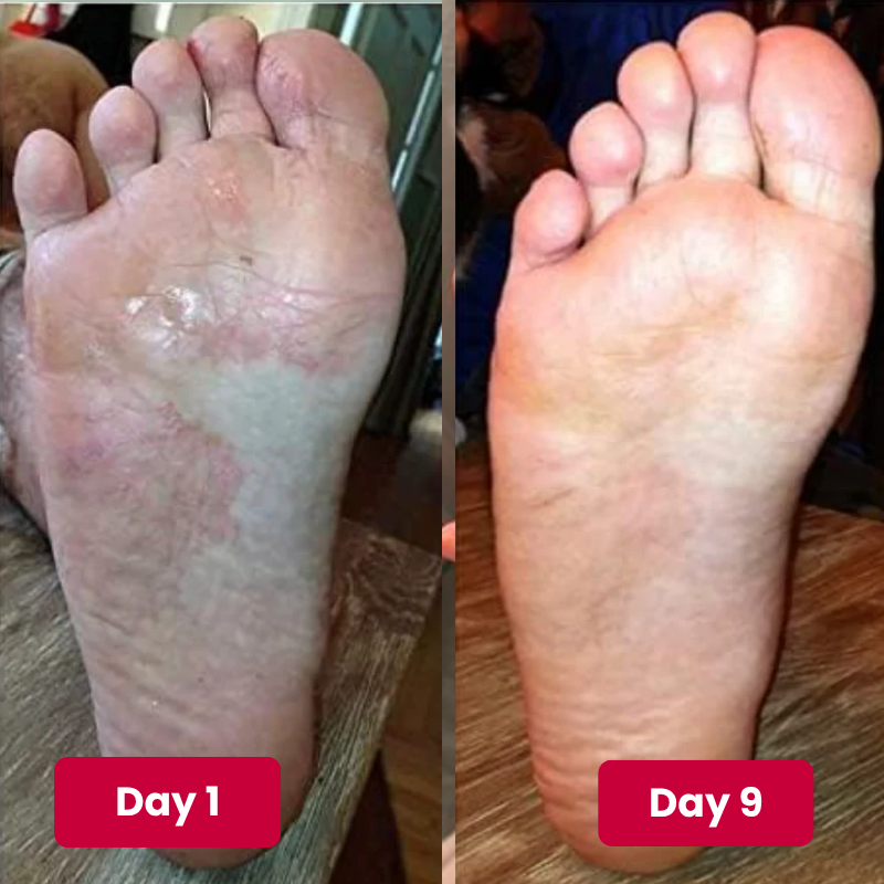 Reboot Labs™ Anti-Fungal Ointment