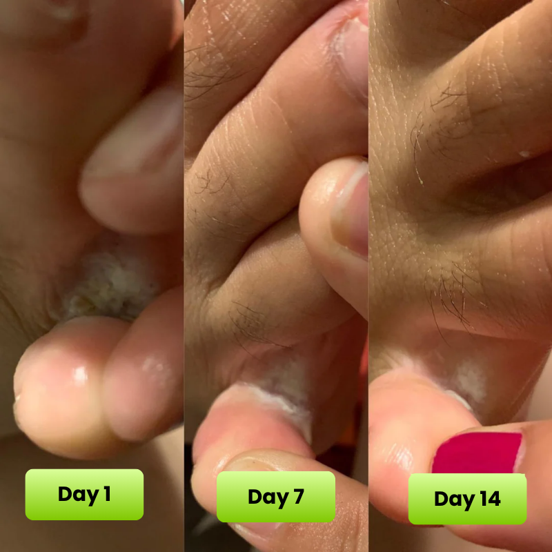 Reboot Labs™ Anti Fungal Tea Tree Oil Soap