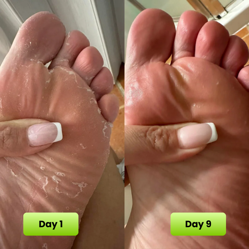 Reboot Labs™ Anti Fungal Tea Tree Oil Soap