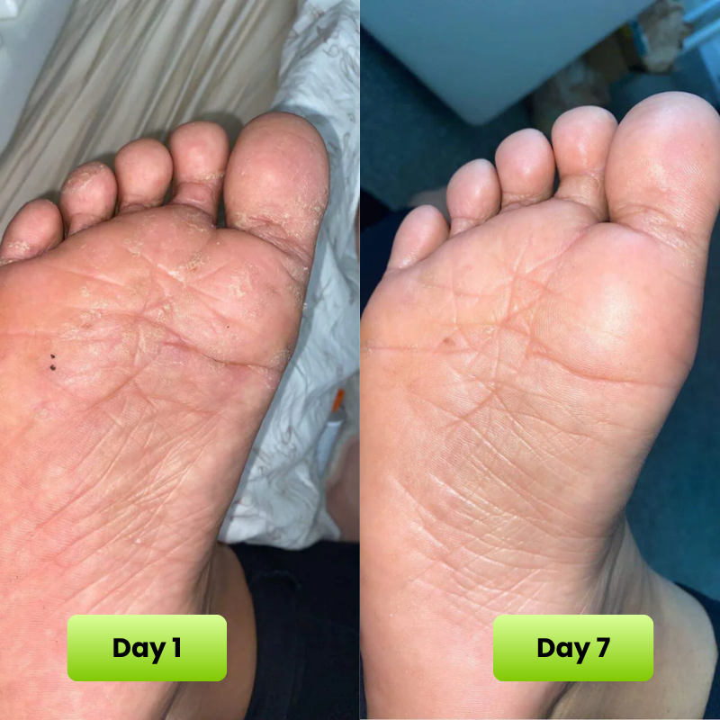 Reboot Labs™ Anti Fungal Tea Tree Oil Soap