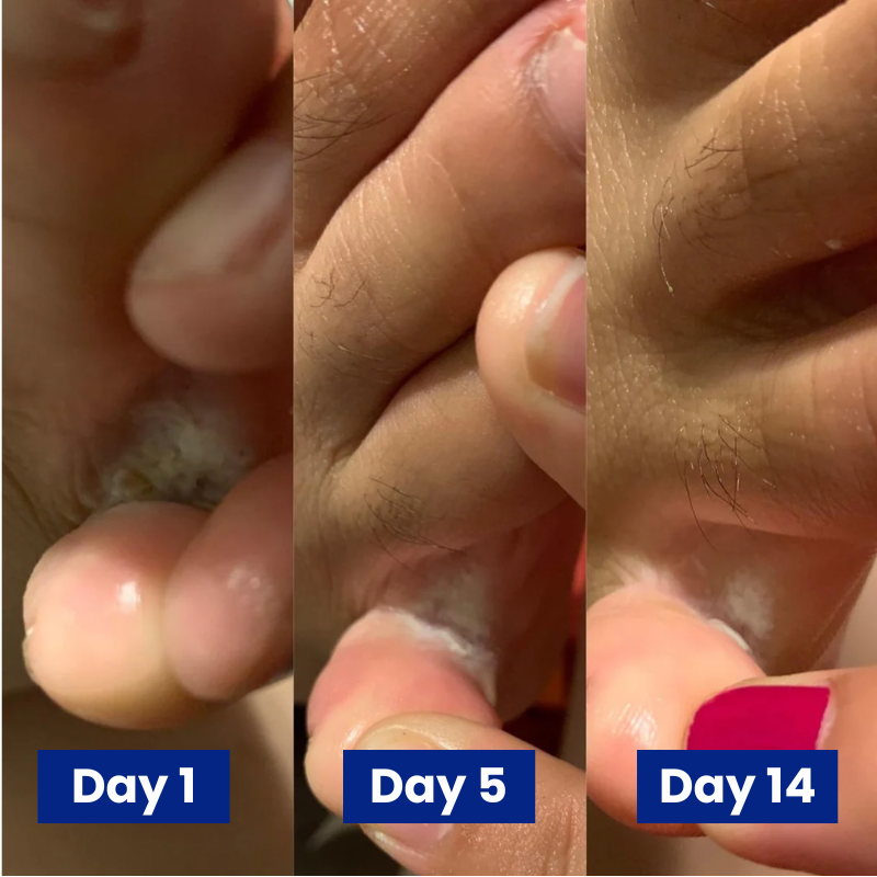 Reboot Labs™ Anti-Fungal Spray for Athlete’s Foot