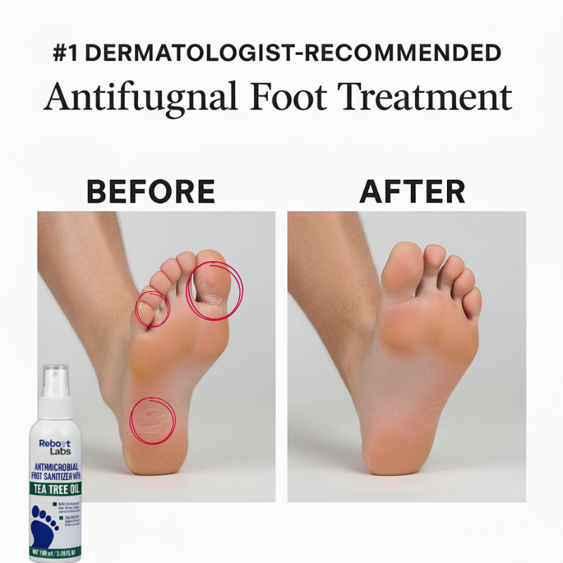 Reboot Labs™ Anti-Fungal Spray for Athlete’s Foot