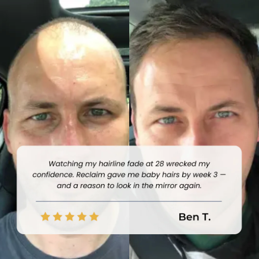 nooli. Hair Growth Roll on Serum
