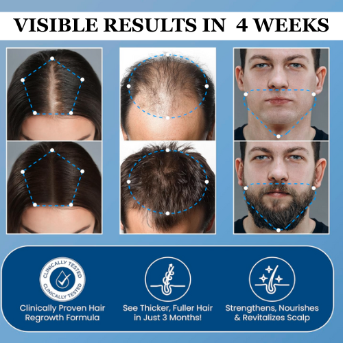 nooli. Hair Growth Roll on Serum